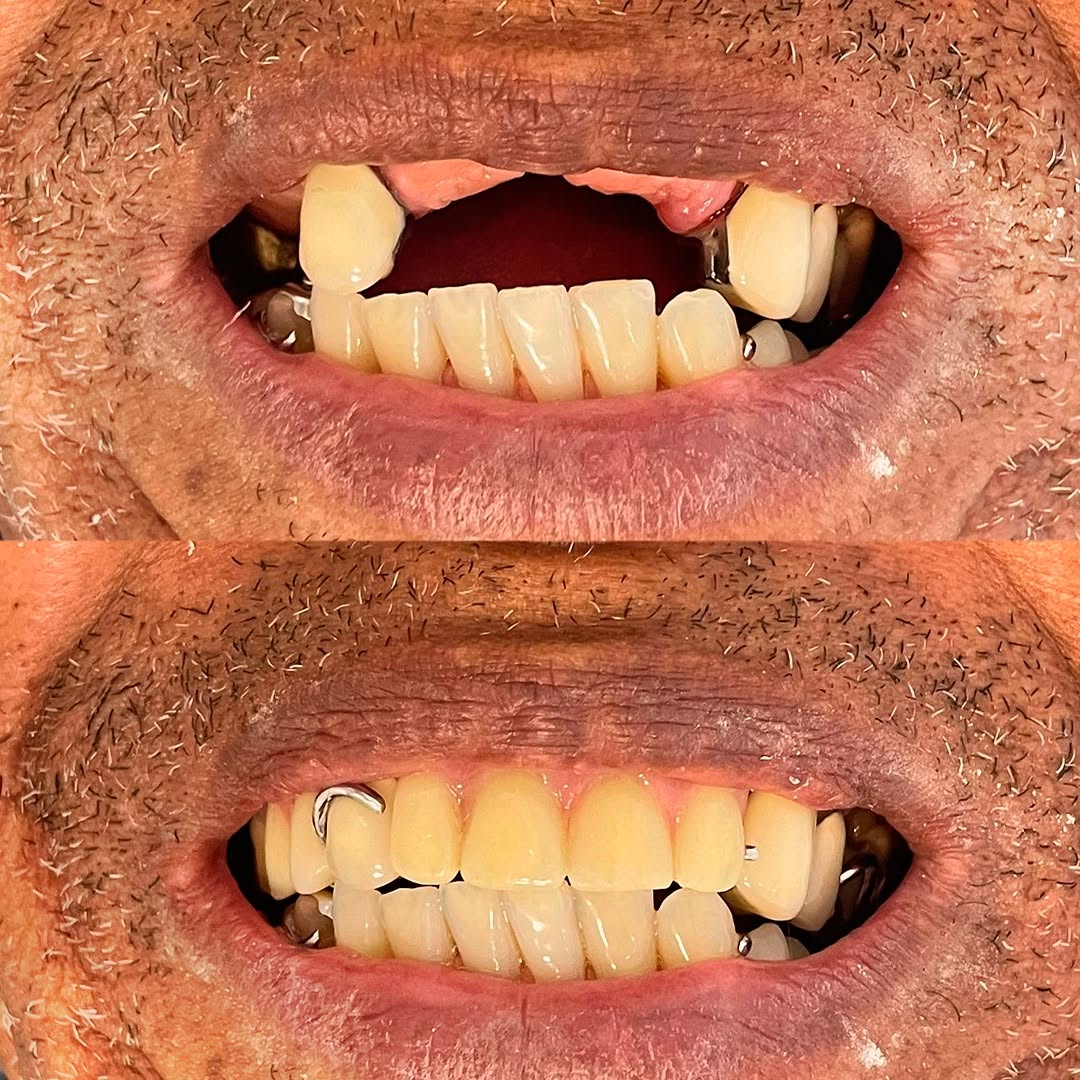 Snapinst.app_437365410_18012201194353695_6551728196914162323_n_1080