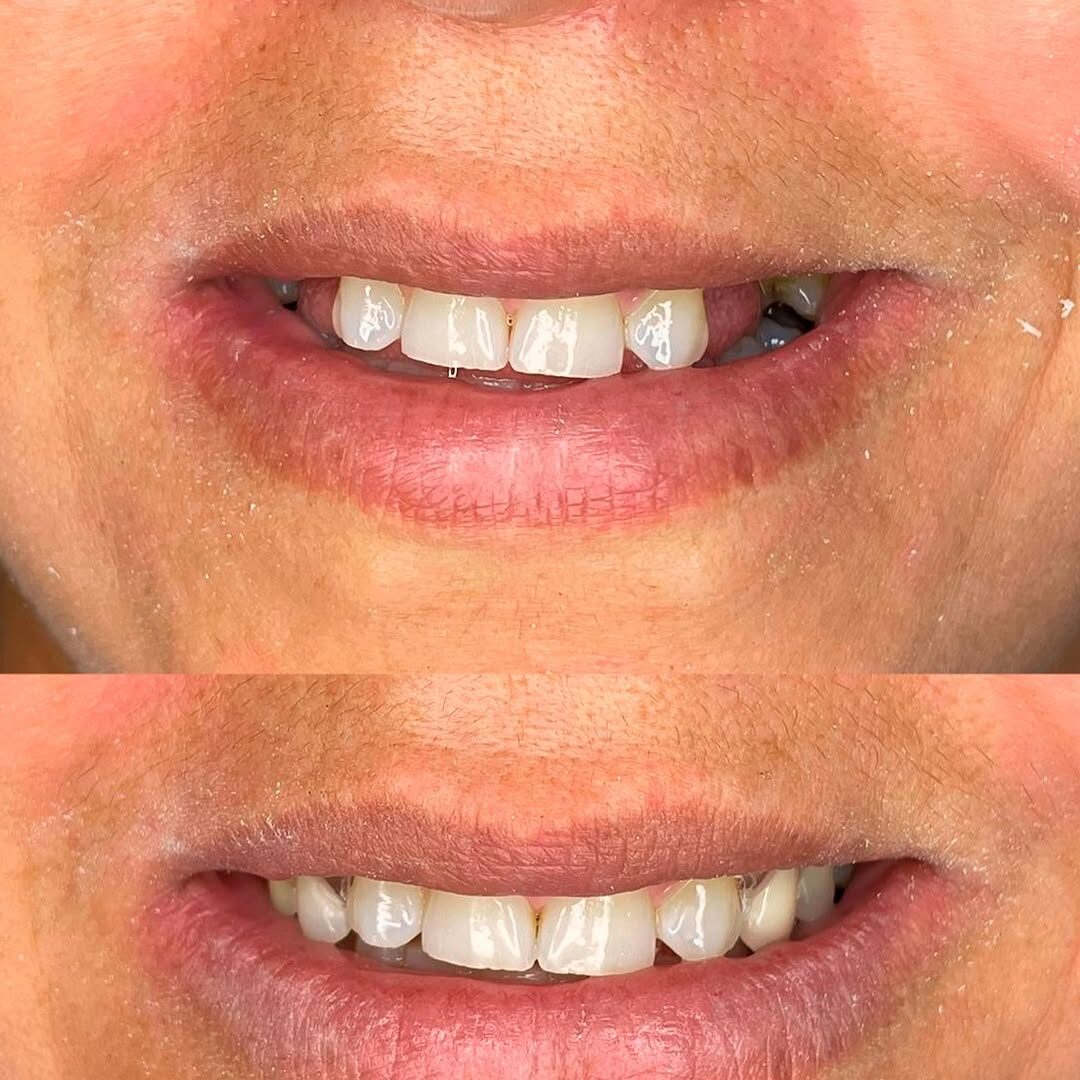 Snapinst.app_475876108_18042827459353695_1992701838110400898_n_1080